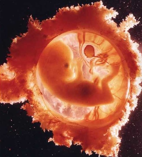 Embrion